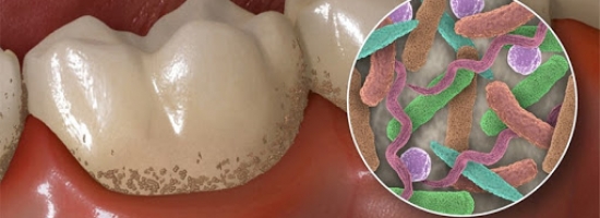 Légy résen! -Mind the gap!